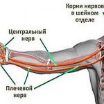 My hands go numb at night. Reasons for sleep, what to do, how to treat, which doctor to see 