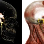 Невралгия тройничного нерва