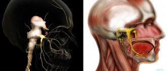 Trigeminal neuralgia