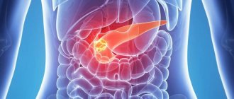 Острый панкреатит