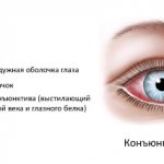 Отличия здорового глаза и больного