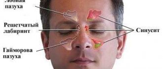 Отривин Комплекс Otrivin Complex инструкция по применению