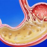Отзыв о Таблетки AstraZeneca