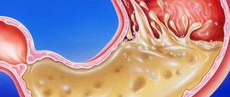 Review of AstraZeneca Tablets