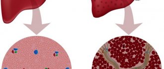 Патологии печени