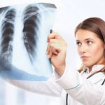 пневмофиброз легких