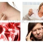 Side effects after taking the drug