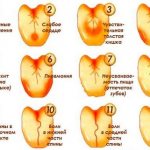 Причины налёта на языке