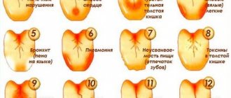 Causes of plaque on the tongue