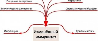 Причины псориаза