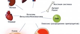 Causes