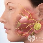 Признаки паратонзиллярного абсцесса