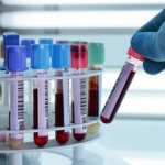 Протромбиновый индекс: норма и отклонения