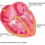 Расположение синусового узла в сердце