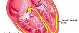 Расположение синусового узла в сердце