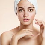 Itchy skin irritation