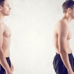 Развитие кифоза