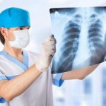 рентген-диагностика милиарного туберкулеза