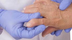 Ревматоидный артрит: аутоиммунное заболевание, причина повышения температуры
