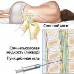 Roseola in children. Symptoms, what the initial stage looks like, treatment. Clinical guidelines 