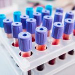 Seborrhea of ​​the face, head, body. Causes, symptoms, photos and treatment 