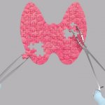 щитовидная железа