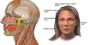 Схема расположения и заболеваний лицевого нерва