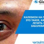 симптомы и лечение халязиона