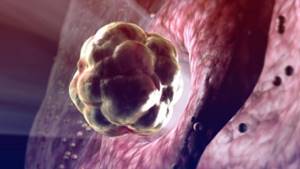 Симптомы имплантации эмбриона: на какой день после зачатия происходит прикрепление плодного яйца?