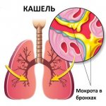 Сироп солодки от кашля. Инструкция по применению от мокрого и сухого, дозировка, рекомендации врачей