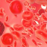 сколько живут с острым лейкозом крови