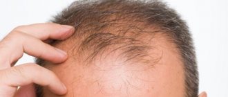 composition of alerana shampoo for hair loss