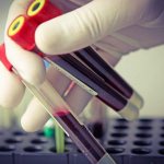 CRP blood test: what is it?