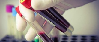 CRP blood test: what is it?