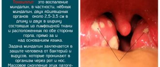 Стрепсилс (Strepsils) спрей для горла. Инструкция по применению с лидокаином, цена, отзывы