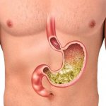 TOP 6 drugs for the treatment of high stomach acidity