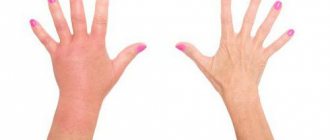 тригрим аналоги