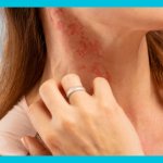 у девушки аллергическая реакция на шее