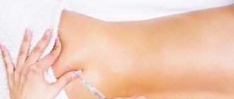 Injection in the buttock