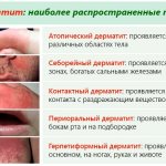 Vitaon balm Karavaev. Reviews, instructions for use for the nose, mouth, face 