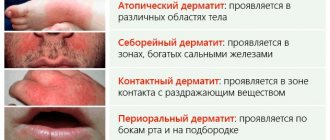 Vitaon balm Karavaev. Reviews, instructions for use for the nose, mouth, face