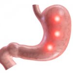 Язва является серьезным и опасным заболеванием