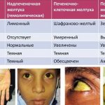 желтуха симптомы у взрослых
