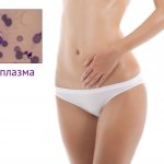 Woman and image of mycoplasma