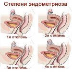 Female gynecological diseases. Symptoms, discharge, itching. List and treatment 